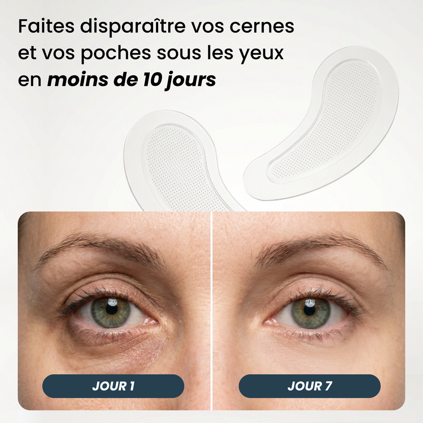 Patchs Anti-Cernes Microneedling