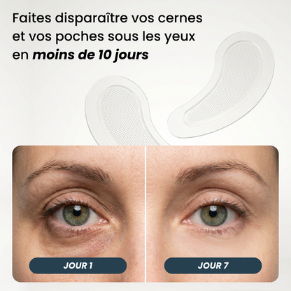 Patchs Anti-Cernes Microneedling